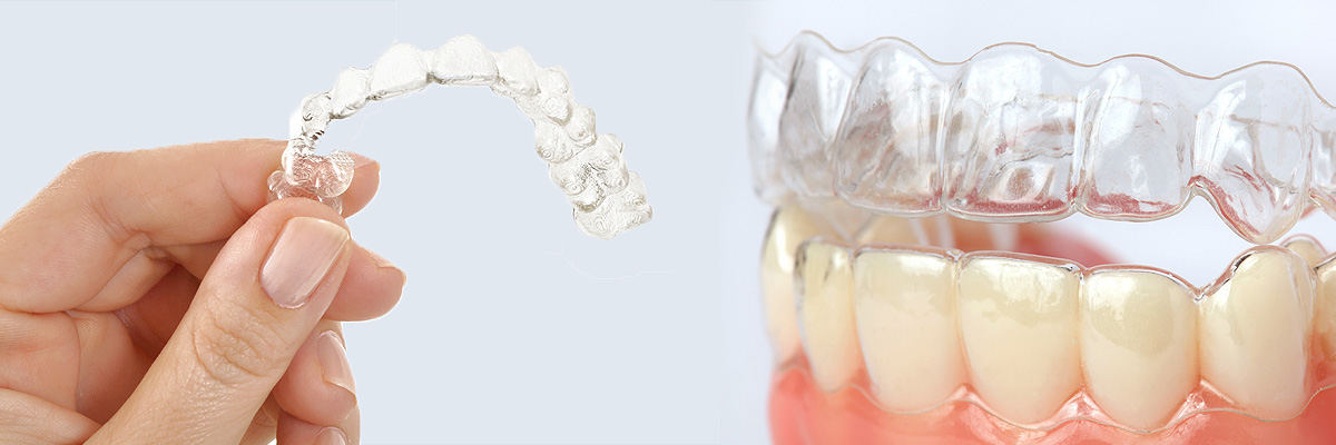 Chesterfield Alternative to Braces for Teens