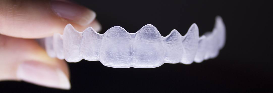 Chesterfield Clear Aligners