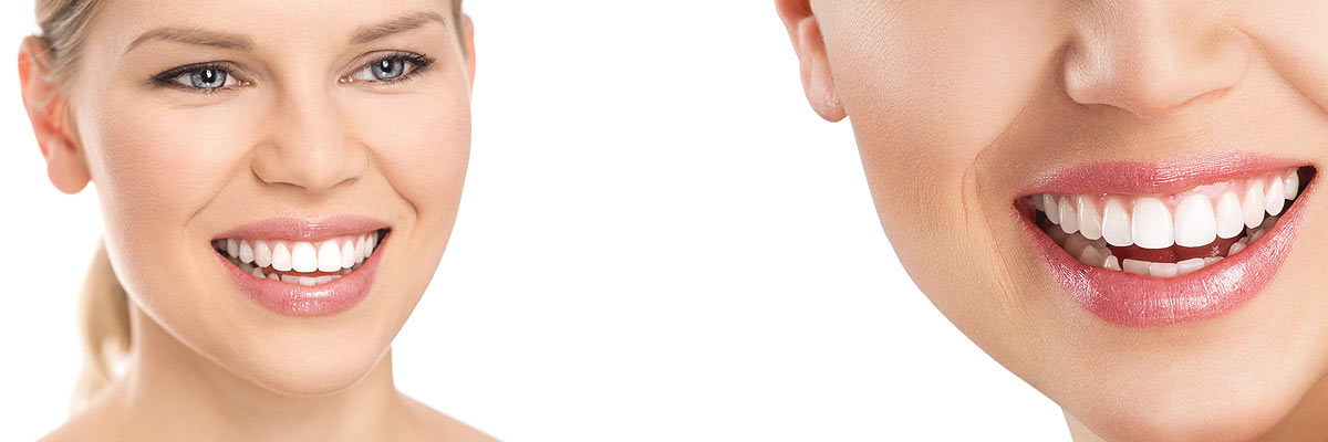 Chesterfield Cosmetic Dental Care