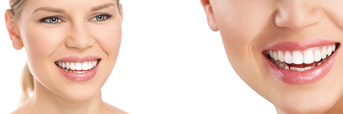 Chesterfield Cosmetic Dental Services