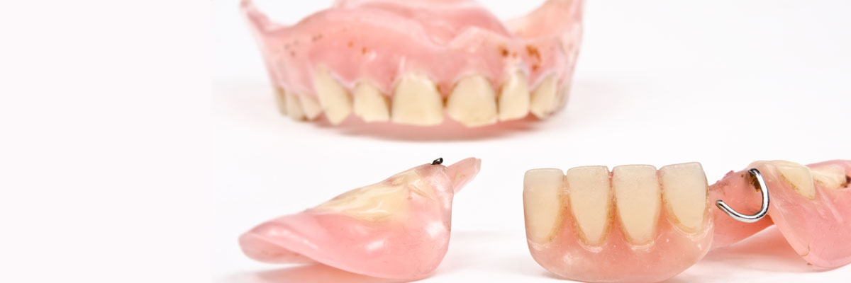 Chesterfield What Do I Do If I Damage My Dentures?