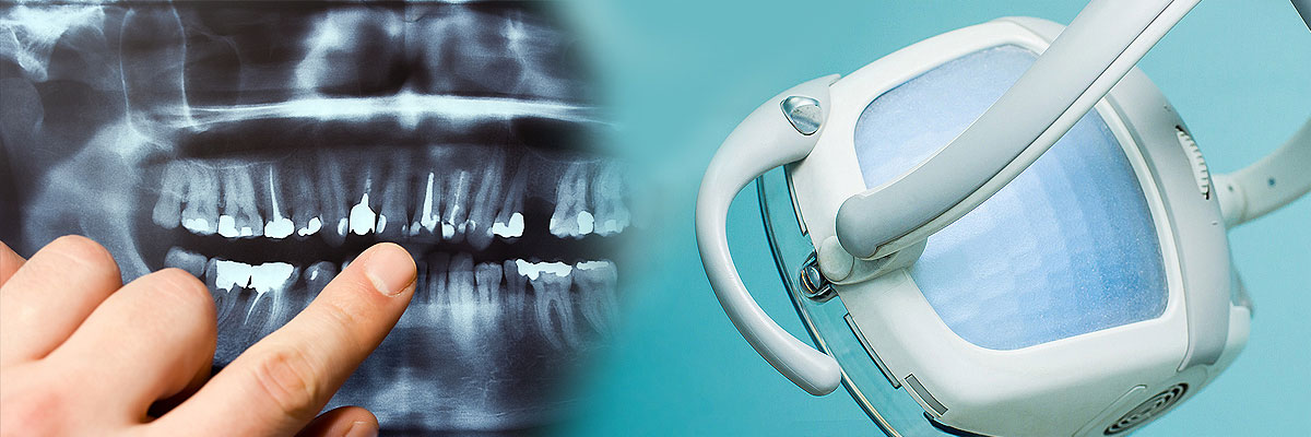 Chesterfield Dental Cleaning