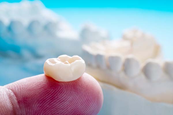 How Many Appointments Are Needed To Get A Dental Crown?