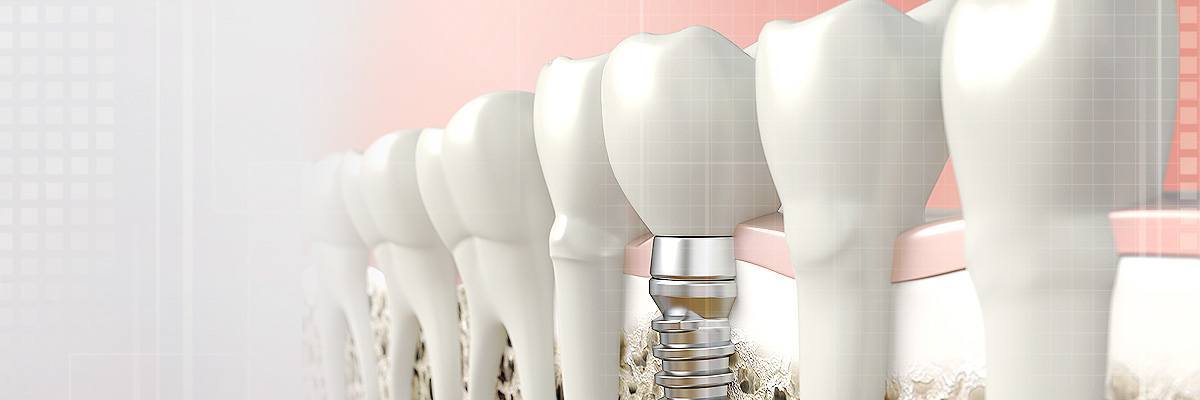 Chesterfield Dental Prosthetics