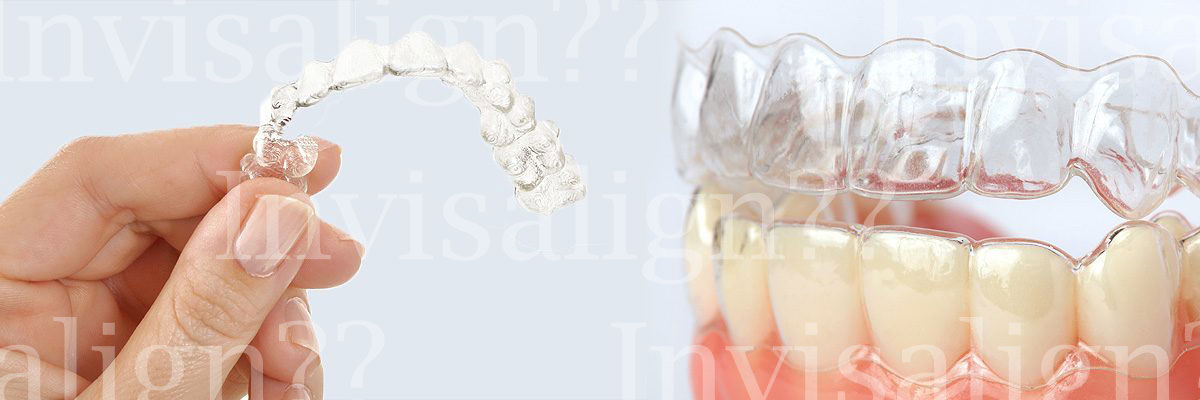 Chesterfield Does Invisalign® Really Work?
