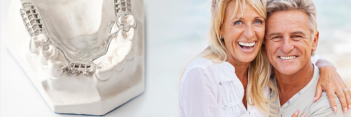 Chesterfield Implant Supported Dentures