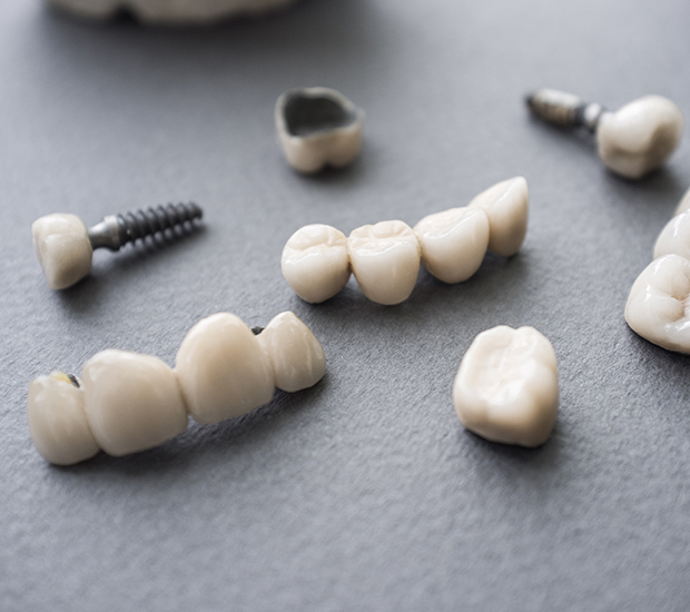 Chesterfield The Difference Between Dental Implants and Mini Dental Implants