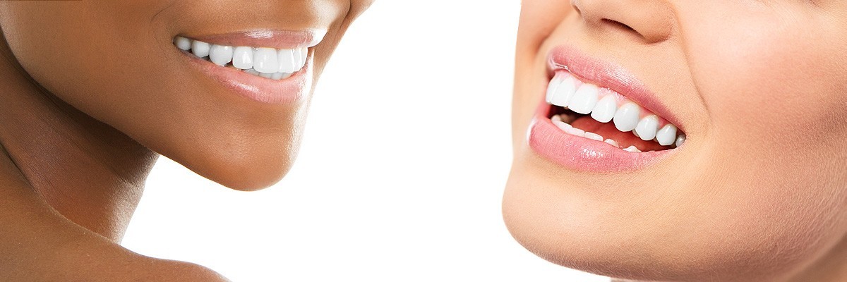 Chesterfield Improve Your Smile for Senior Pictures