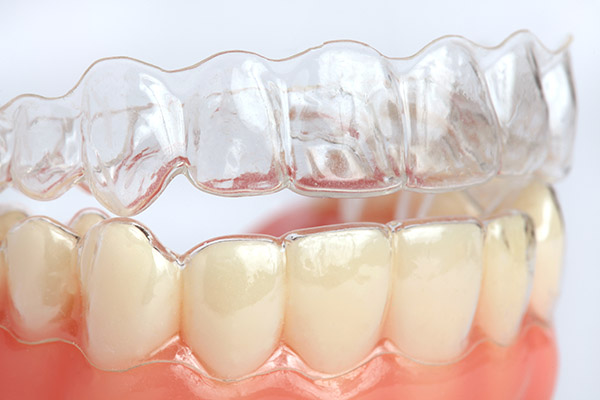 Invisalign® Braces