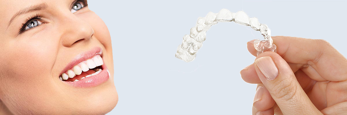 Chesterfield 7 Things Parents Need to Know About Invisalign Teen