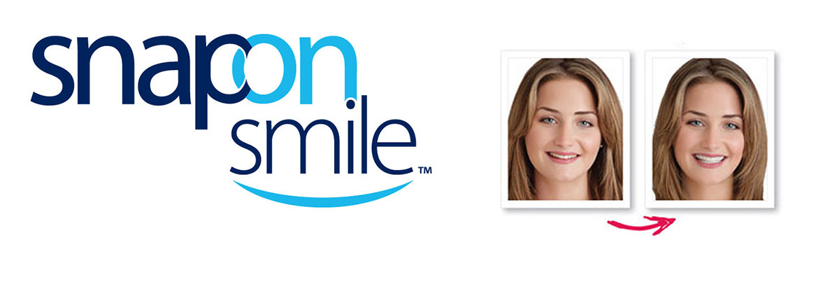 Chesterfield Snap-On Smile