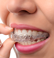 Clear Aligners - Almost Invisible Braces Chesterfield, MO