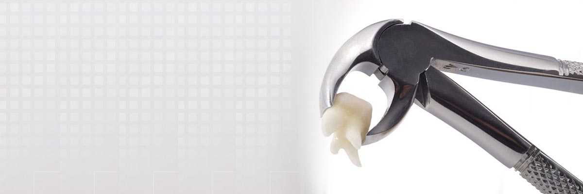 Chesterfield Tooth Extraction