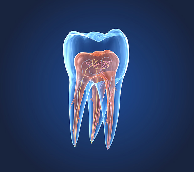 Chesterfield What is an Endodontist